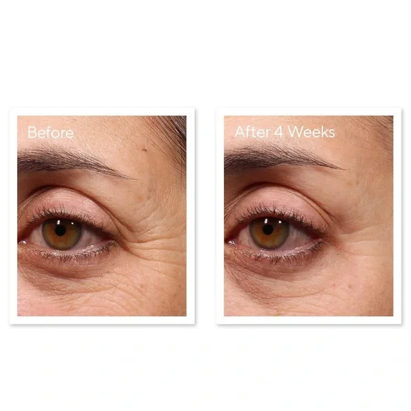 🌿 Murad Retinol Youth Renewal Eye Serum - Picture 4 of 9